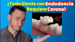 Si tienes Endodoncias, necesitas Corona en esos dientes. ¿Mito o realidad?