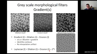 Advanced Image Processing with MorphoLibJ  - [NEUBIASAcademy@Home] Webinar