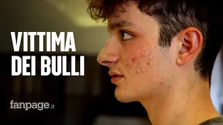 Leonardo vittima dei bulli: "Mi hanno mandato al pronto soccorso e dato fuoco ai vestiti"