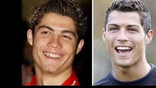 Cristiano Ronaldo before and after plastic surgery