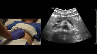 Abdominal Aorta and Pancreas Ultrasound Scanning Technique