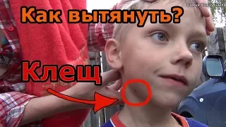 3 ПРОСТЫХ способа КАК вытащить КЛЕЩА