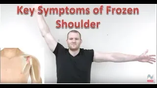 Frozen Shoulder Symptoms - Adhesive Capsulitis Examination