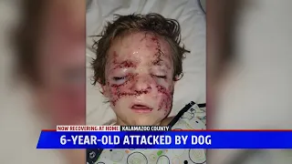 6-year-old attacked by dog