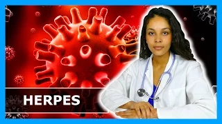 HERPES - WAS TUN? Fieberbläschen wieder loswerden - Lippenherpes behandeln & vorbeugen