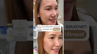 รีวิว ไหมน้ำ "Ultracol"