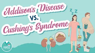 Addison's Disease vs. Cushing's Syndrome - Signs & Symptoms