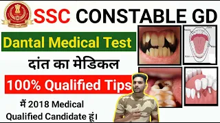 SSC GD Danton ka MEDICAL | SSC GD Dental Medical Test Full Process ! SSC GD Constable दांत का मेडिकल