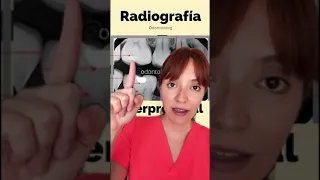 Radiografía interproximal o de aleta de mordida #shorts