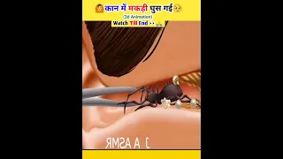 कान में मकड़ी🕸️🕷️घुस जाए तो🥺😱| Spider In Ear asmr treatmen #shorts #viral #asmrsatisfying @CrazyXYZ