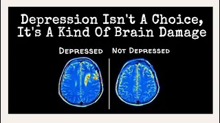 „Depressionen gibt es nicht“ - Meine Aufklärung