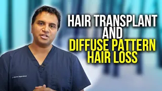 Hair Transplantation In Men With Diffuse Pattern Hair Loss