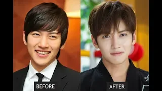 Kdrama actors before& after plastic surgery