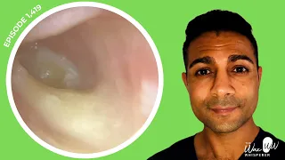 1,419 - Microsuction of Swimmer’s Ear Bacterial Infection | Patient in Extreme Pain