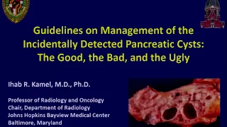 Guidelines on Management of Incidental Pancreatic Cysts-- Ihab Kamel, MD (SABI 42nd Annual Course)