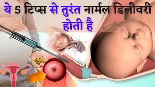 ये 5 तरीको से तुरंत नार्मल डिलीवरी होती है| Natural tips for Normal Delivery In Hindi|