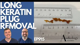 LONG KERATIN PLUG REMOVAL - EP915