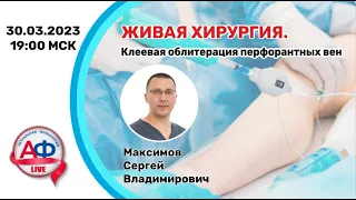 Клеевая облитерация перфорантных вен АФ Live 30/03/2023