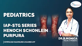 Pediatrics | IAP STG Series Henoch Schonlein Purpura | Raaonline #pediatrics #nephrology #stg