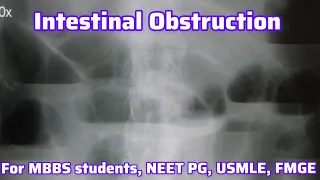 Intestinal obstruction For MBBS students, Neet PG, Usmle, FMGE I Neet PG Usmle Preparation