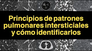 Principios de patrones pulmonares intersticiales y cómo identificarlos