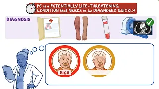 MyEMCert Key Advance | Outpatient Treatment for Pulmonary Embolism