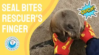 Seal Bites Rescuer's Finger