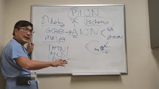 Posterior Ischemic Optic Neuropathy (PION)