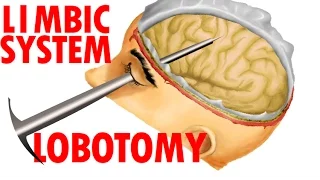 Limbic System Anatomy - Lobotomy And Human Emotions