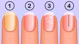 5 Things Your Nails Can Tell You About Your Health