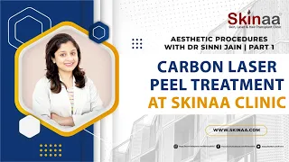 CARBON LASER PEEL TREATMENT AT SKINAA CLINIC | Aesthetic Procedures with Dr. Sinni Jain Part 1