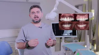 علاج امراض اللثة في جدة - المجمع التخصصي لطب وزراعة الاسنان