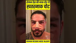 रोमन रेंस की नाक तोड़ दी 😭 | #shorts #wweshorts #wwehindi #romanreigns | Roman Reigns Nose Injury 😢