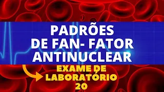 PADRÕES DE FAN - FATOR ANTINUCLEAR - AUTOANTICORPOS