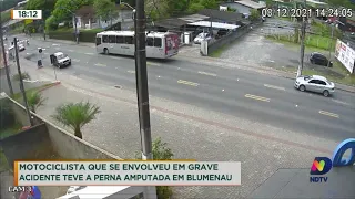 Motociclista acidentado teve perna amputada