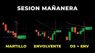 Sesión con ACCION del Precio y Discusión sobre operativas EMPATE (ATM)  y Digitales