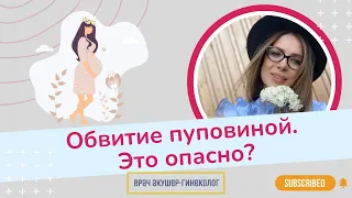 Чем опасно обвитие пуповиной и что делать?/ Виктория Матвиенко