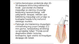 Parodont kasalliklarini tkshirish usullari