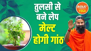 आयुर्वेदिक उपाय से कैसे मेल्ट होगी गांठ? सीखिए Swami Ramdev से एक असरदार लेप बनाने की विधि