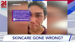 24 Oras Weekend: Skincare gone wrong?