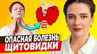 ❗️ АУТОИММУННЫЙ ТИРЕОИДИТ ❗️Основные симптомы, методы лечения, уровни гормонов на разных стадиях АИТ