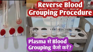 Reverse Blood Grouping Procedure | Reverse Blood Group by Plasma | Blood bank