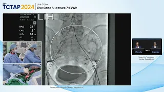 [TCTAP 2024] Live Case & Lecture 7: EVAR