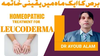 Leucoderma ! Homeopathic treatment of leucoderma ! bars ka ilaj#leucoderma#dr#ayoub#viralvideo