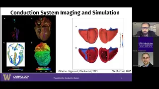 Athletic Training and the Cardiac Conduction System