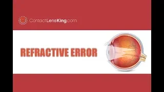 Refractive Error of Eye | Common Refractive Errors | Myopia, Hyperopia, Astigmatism, and Presbyopia