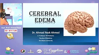 Cerebral Edema Prof Ahmed Rezk