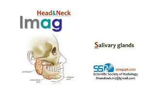 4 Salivary glands Imaging - prof.Mamdouh Mahfouz (2019 edition)