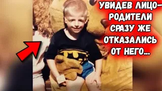 Родная мать отказалась от новорожденного, едва увидев его лицо...