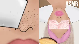 ASMR Acne Face Treatment | Squeeze Blackhead, Hair Brushing, Neck Massage | Beauty ASMR Animation